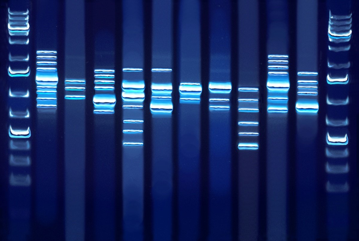Gel de electroforesis con bandas de ADN — análisis genómico LASEM