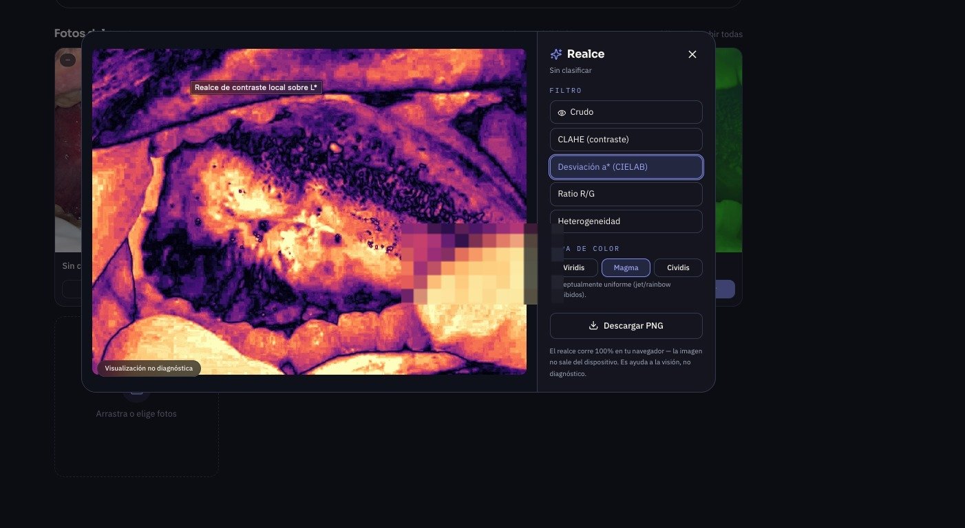 Herramienta de realce de imagen CIELAB corriendo en el navegador — visualización no diagnóstica